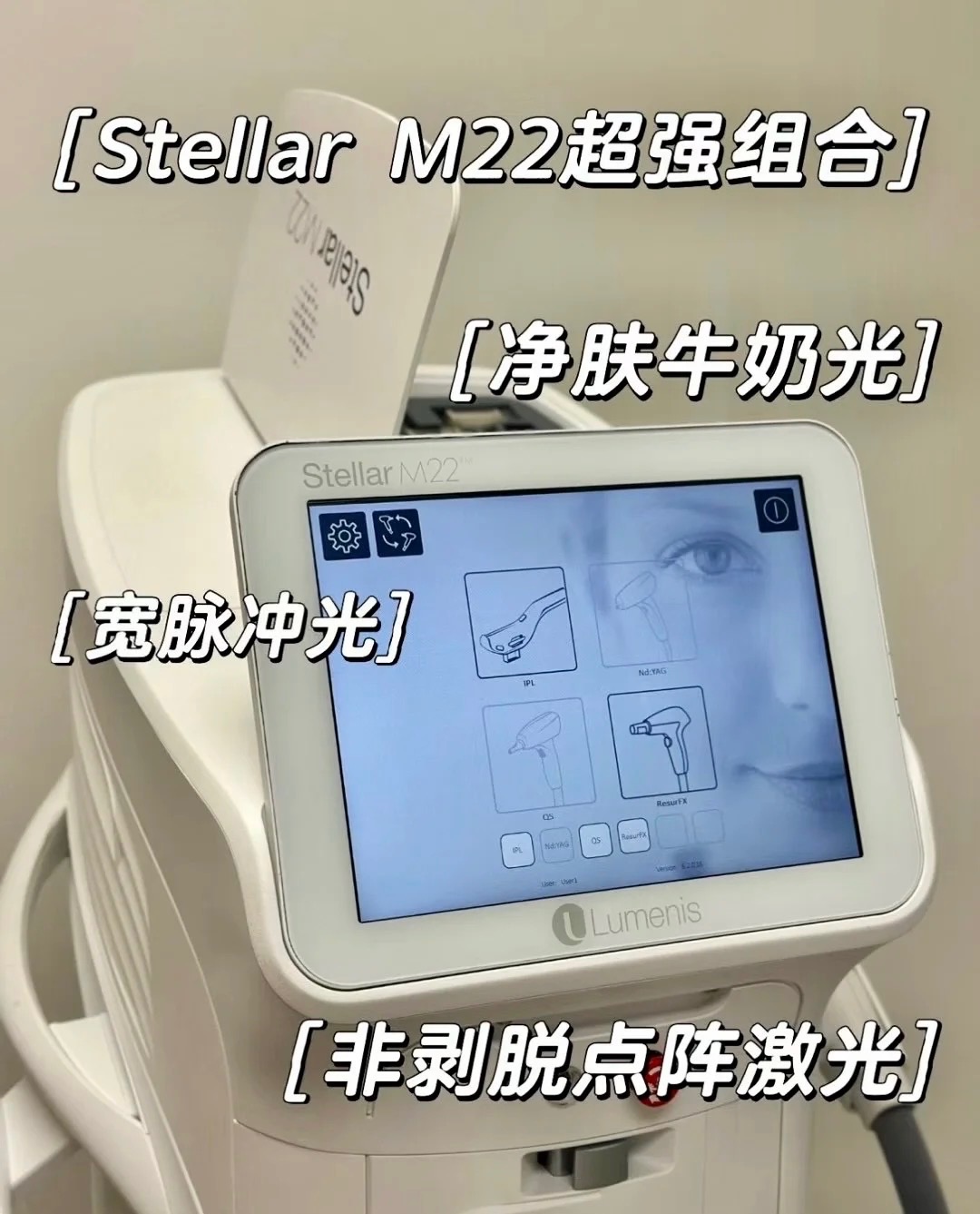 M22 IPL