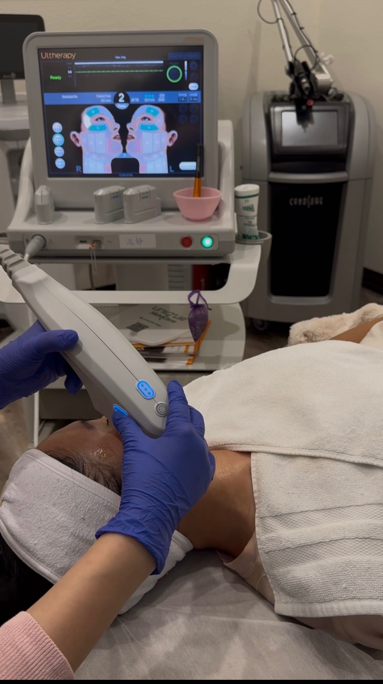 Ultherapy 